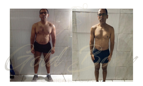 Resultados Gold Body